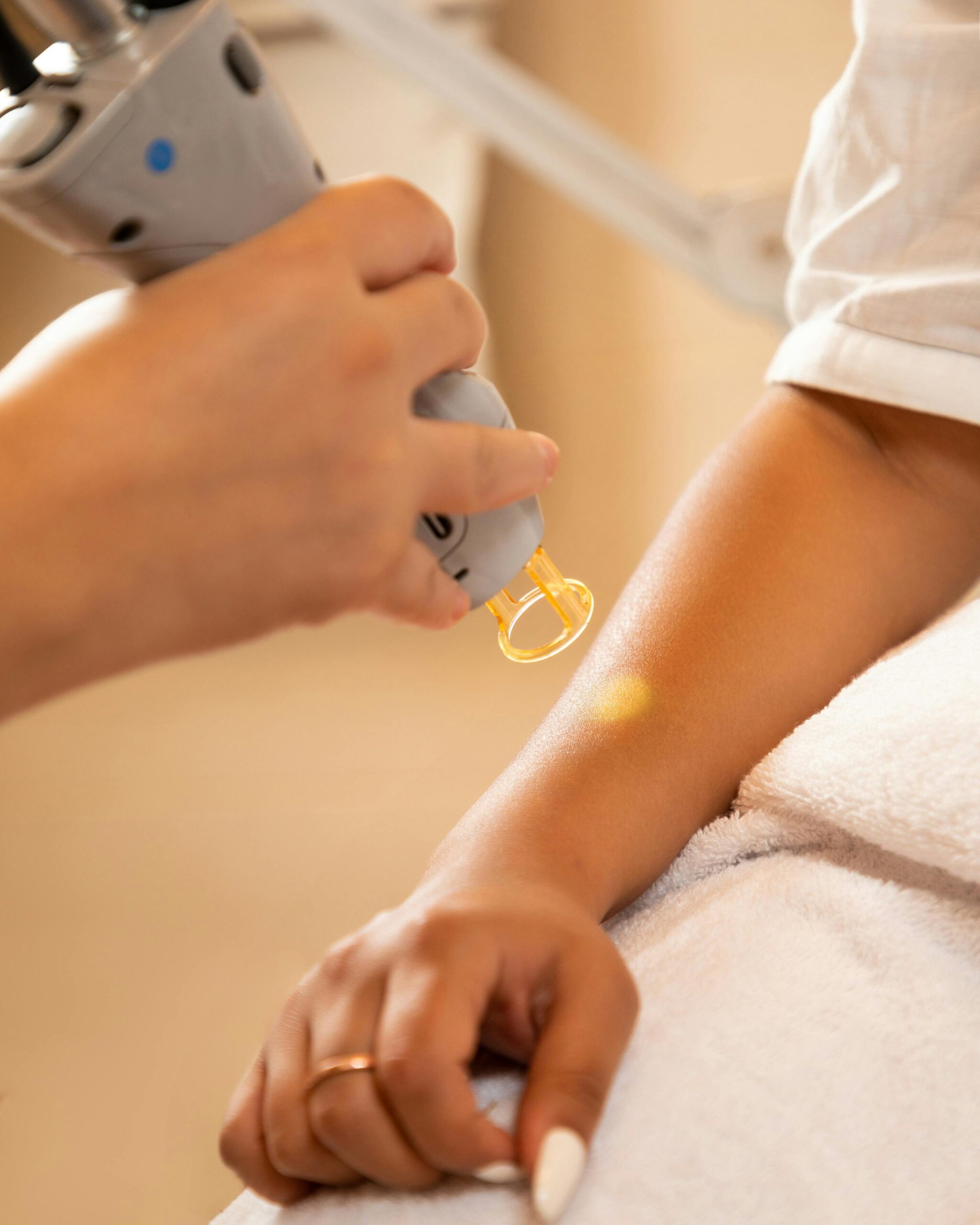 Skin care before laser: Avoid sun exposure for skin safety and best laser treatment results.