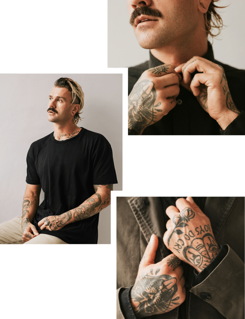 Tattoo Removal in Amsterdam