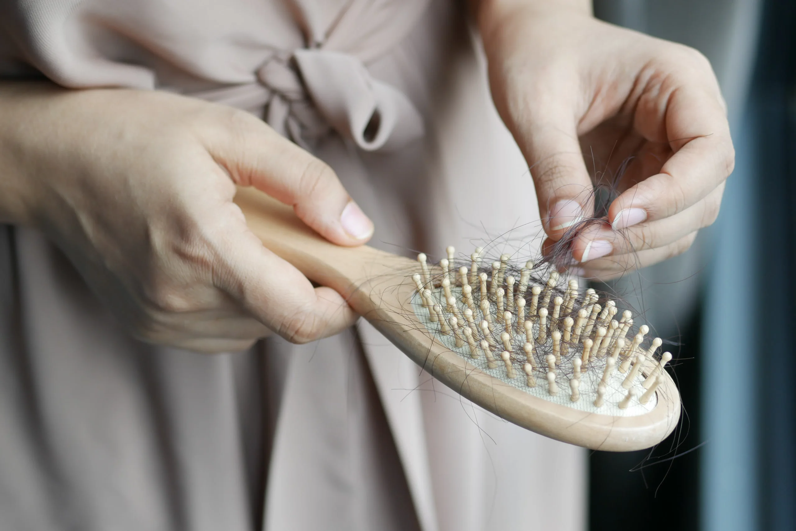 Hair loss on a hairbrush, emphasizing the concern for hair health and potential solutions like laser waxing to manage unwanted hair.