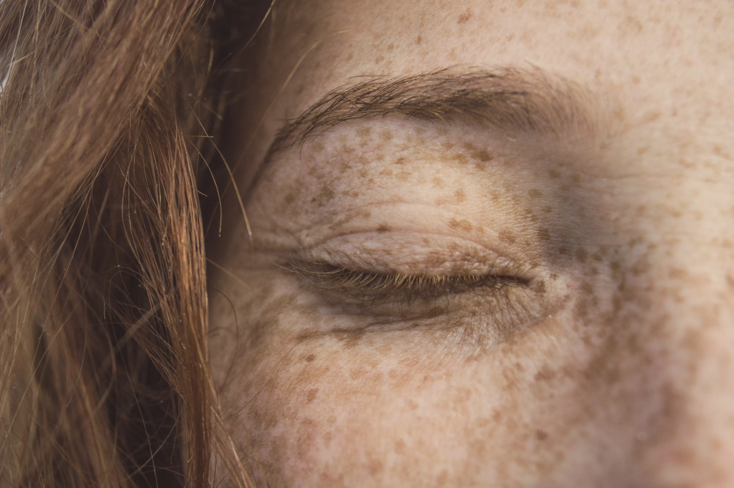 Close-up of a closed eye with freckles, showcasing natural skin texture.