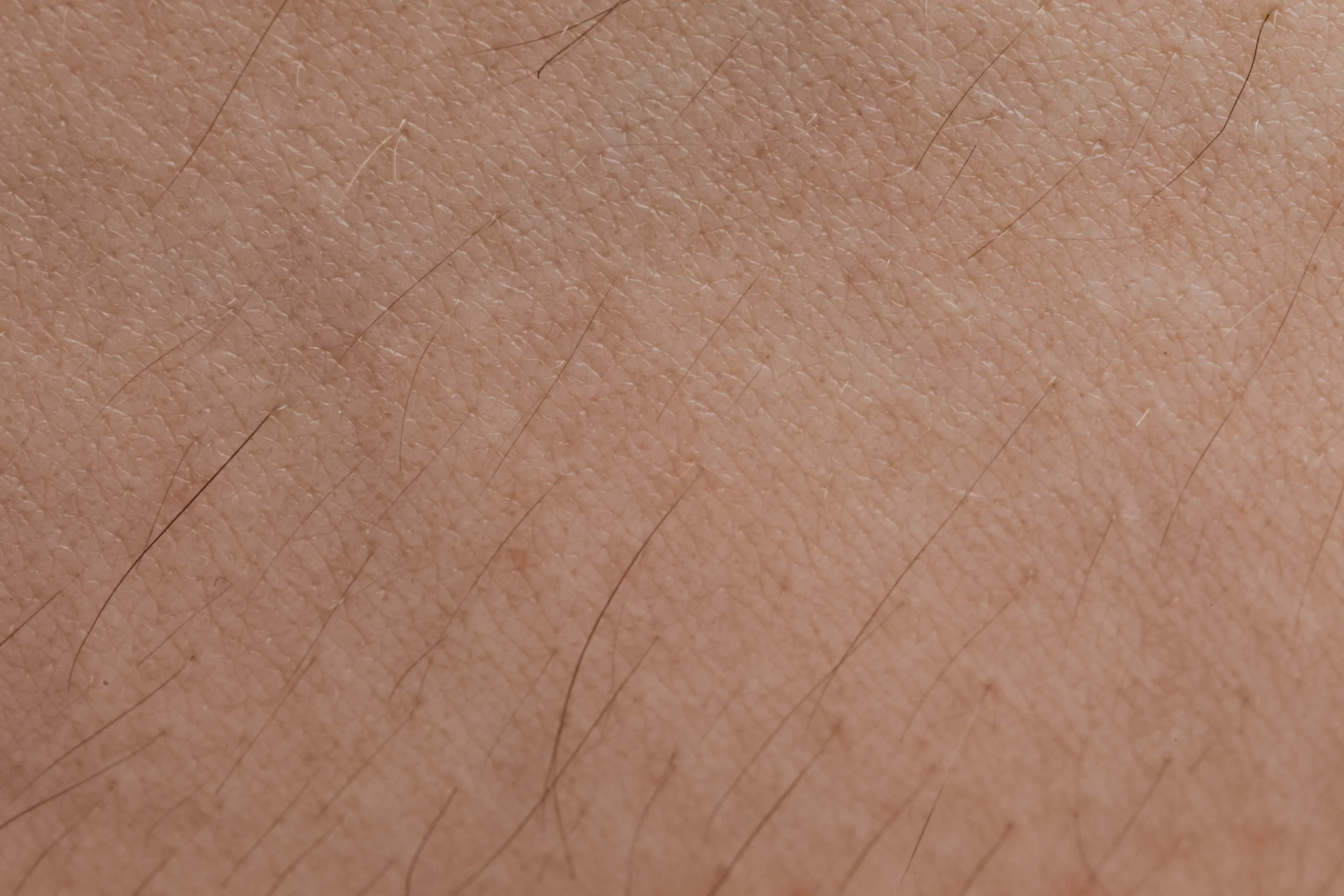 Close-up of skin with body hair before laser hair removal