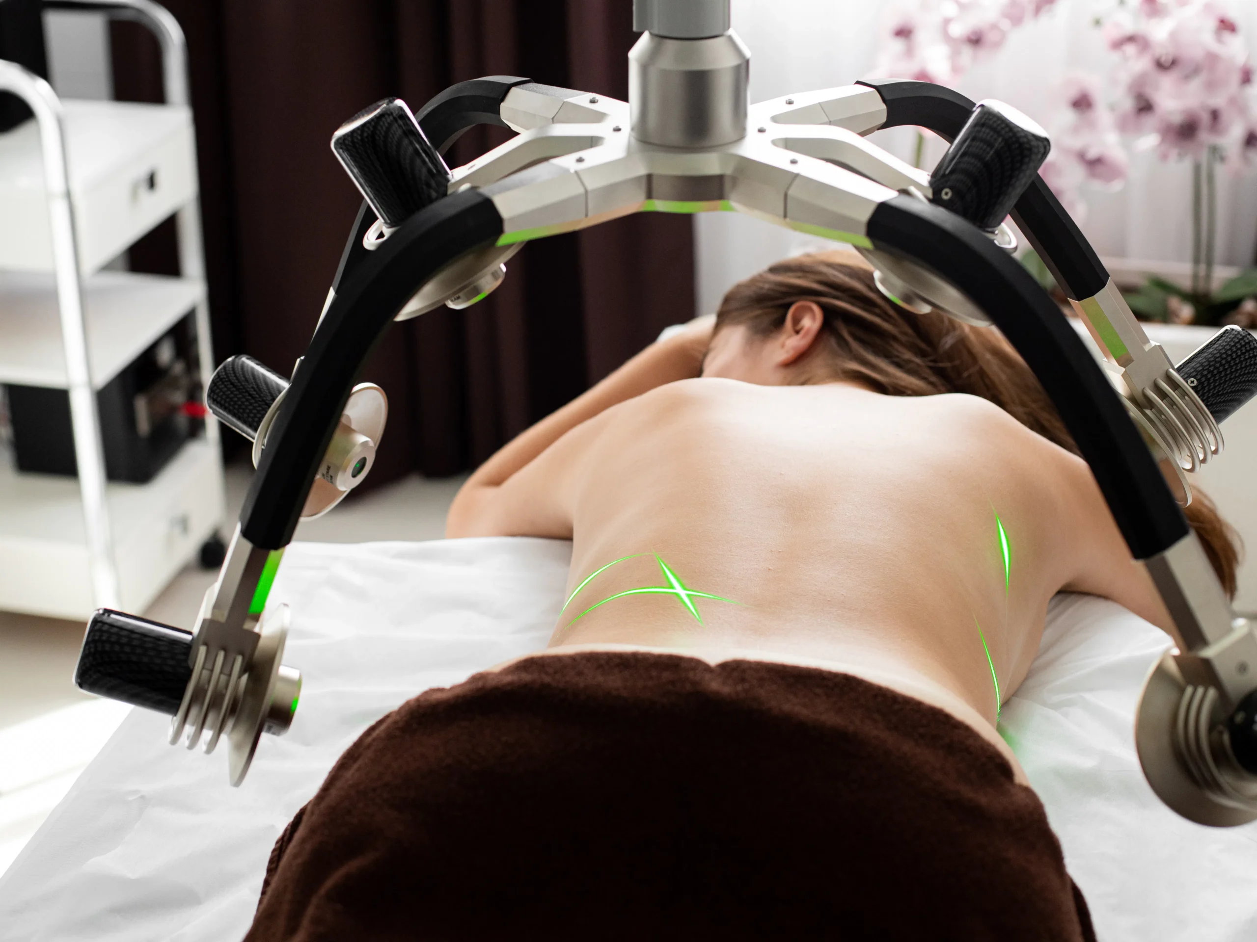 Woman receiving laser treatment for hair removal on her back.