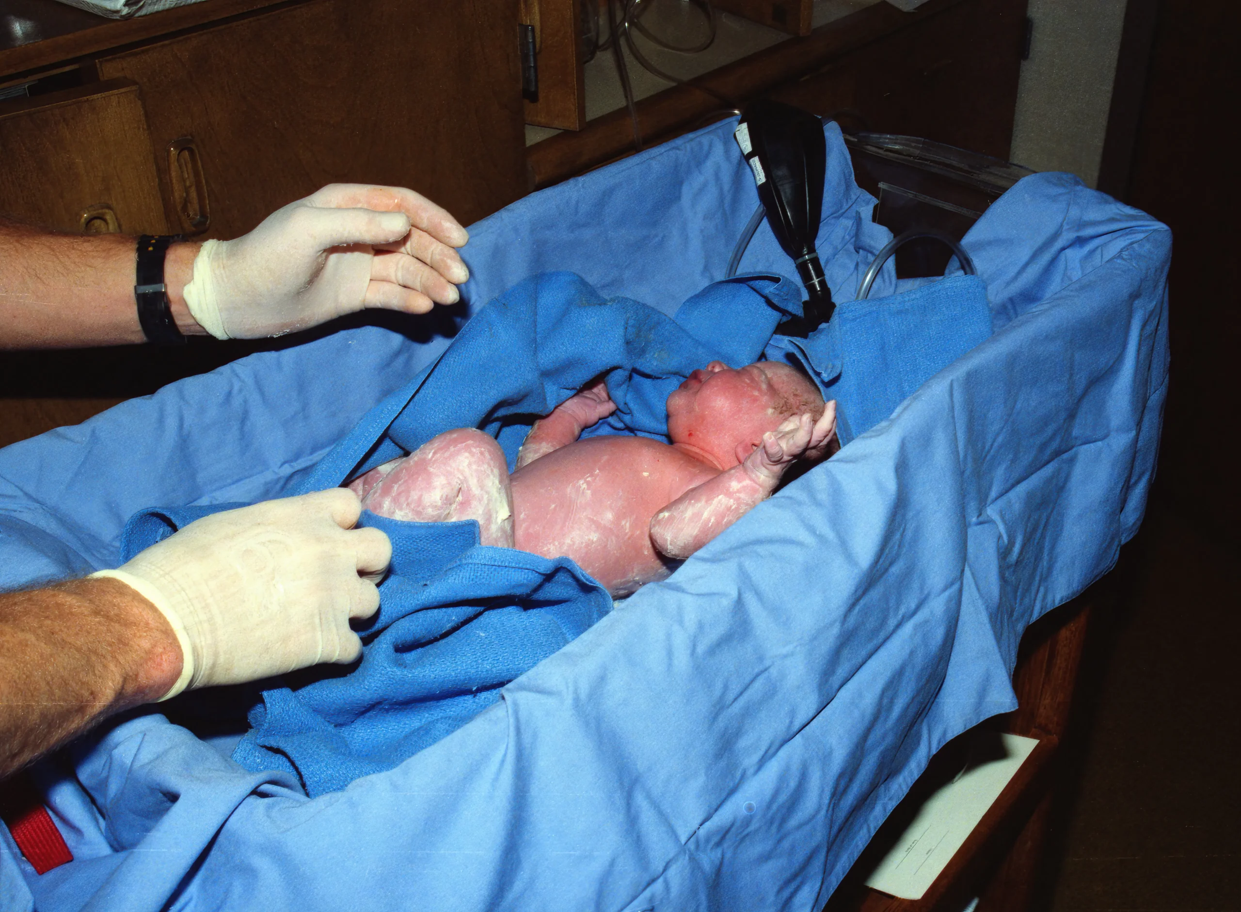 Newborn baby in hospital bassinet attended by gloved medical staff.