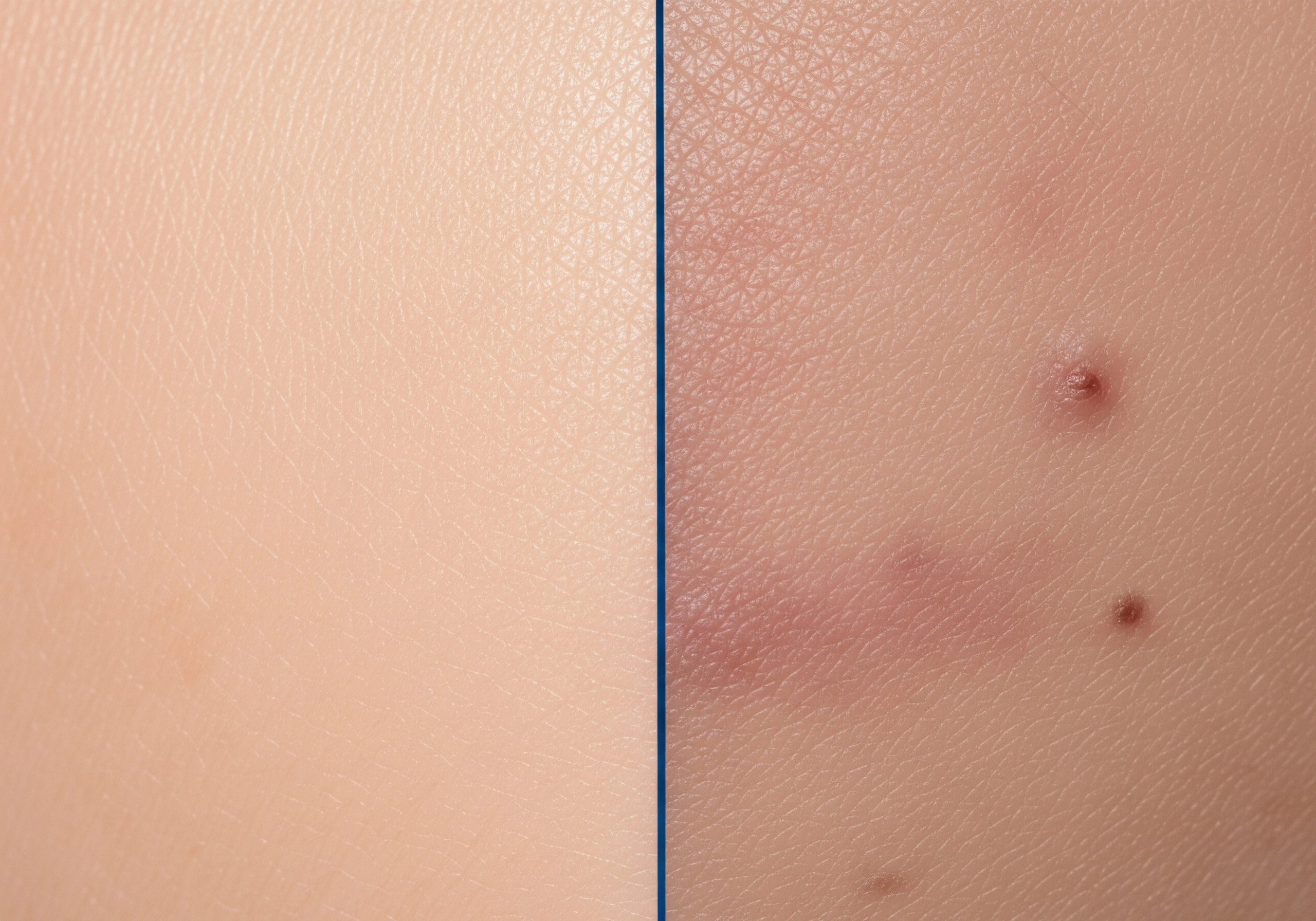 Close up of skin before and after carbon peel treatment, showing reduced blemishes.