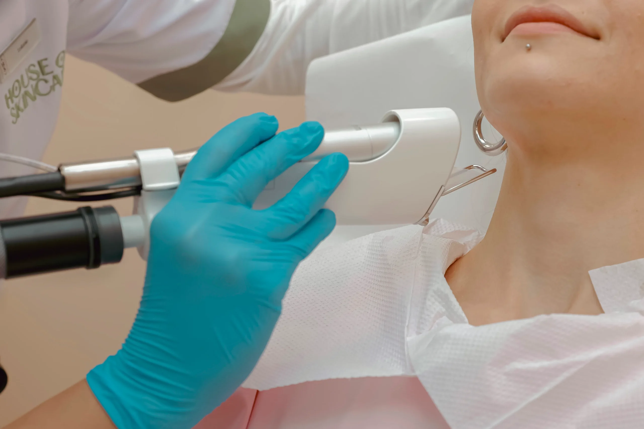 Carbon peel Amsterdam: Technician applies laser during skin treatment, close-up.