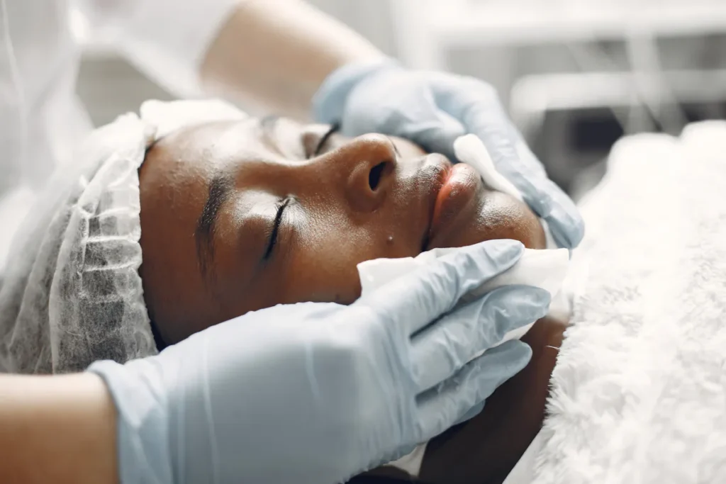Close-up of carbon peeling aftercare in Amsterdam, face being cleaned with cotton pads.